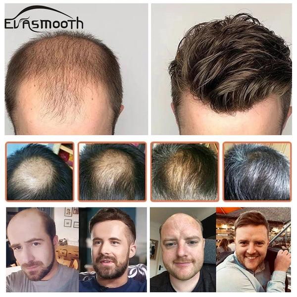 Evasmooth Indian Remy Human Hair Replacement System