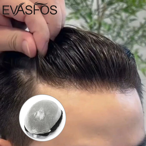 EVASFOS Invisible Capillary 0.03mm Ultra Thin Skin Hair Replacement System